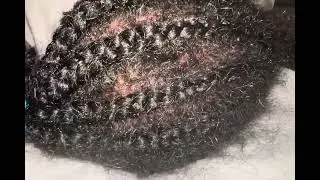 Aggressive Scalp Scratching & Moisturizing ASMR | Tools & Hair Sounds
