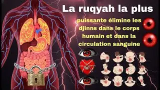 La ruqyah la plus puissante &eacute;limine les djinns dans le corps humain et dans la circulation sanguine
