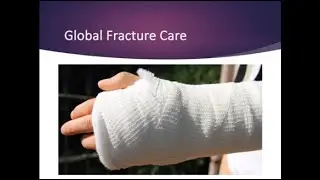 CPT&reg; Coding: Global Fracture Care
