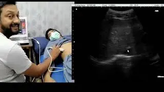 ultrasound training episode 3 urdu/hindi version: Visualising the liver