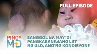 Sanggol na may 'di pangkaraniwang liit ng ulo, ano'ng kondisyon? (Full Episode) | Pinoy MD