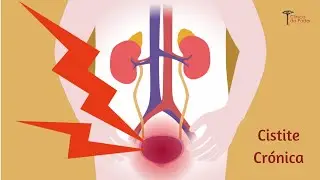 Cistite Cr&oacute;nica - Dr. Jos&eacute; Pereira da Silva