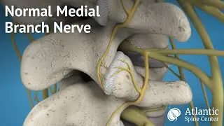 Normal Medial Branch Nerve