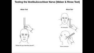 Interpreting the Weber-Rinne Tests EXPLAINED