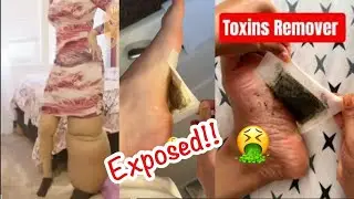 how to apply detox foot patches honest review |how to use kinoki cleansing detox foot pads| feet pad