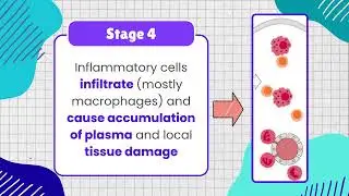 Type IV Delayed Hypersensitivity
