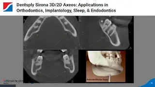 Dentsply Sirona 3D/2D Axeos: Applications in Orthodontics, Implantology, Sleep, & Endodontics
