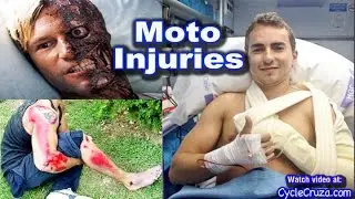 Most Common Motorcycle Injuries and Prevention | Moto Vlog
