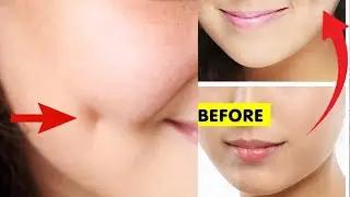 How To Get Dimples Fast & Naturally! Simple Facial Exercises to get Dimples without Surgery