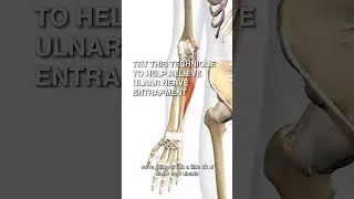 Try This Technique to Help Relieve Ulnar Nerve Entrapment