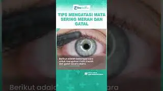 Mata Sering Merah dan Gatal? Jangan Disentuh, Lakukan Sederet Tips Berikut untuk Mengatasinya