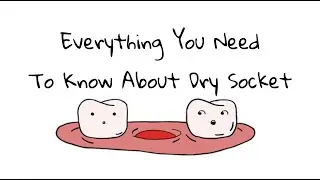 Everything You Need To Know About Dry Socket/Alveolar Osteitis