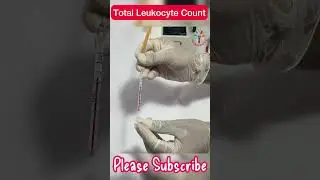 TLC ll Общее количество лейкоцитов Практический ll Количество лейкоцитов ll #патогенез ll #barman...