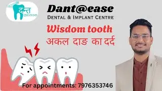 👇Third Molar (Wisdom Tooth) Impaction Surgery &ndash; Explained Simply