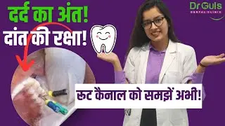RCT क्या है ? Rct की जरूरत क्यों पड़ती है ? जाने इसका Producer l Root Canal Treatment l Tooth Pain