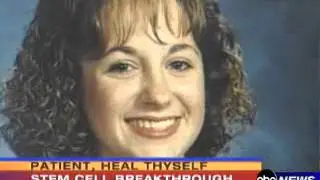 Lupus and Multiple Sclerosis