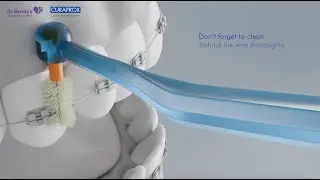 Dr. Reddy's | Curaprox Ortho Kit | Explainer Video