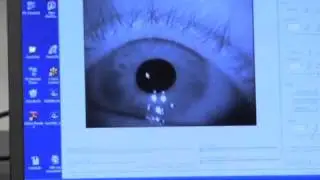 ASL Mobile Eye Demo