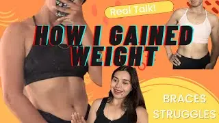 How I Gained Weight During My Braces Struggles (Real Talk!)