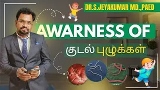 Worms in Kids – What Every Parent Sould know உங்கள் குழந்தைக்கு புழு தொற்று இருக்கிறதா?