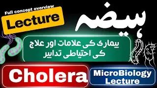 Cholera Symptoms and Treatment! (2024)