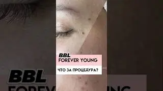 Forever young BBL. Что за процедура?  
