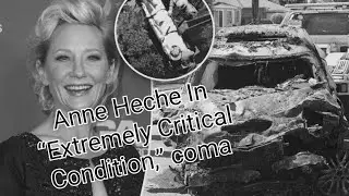 Anne Heche In Extremely Critical Condition&rdquo; Remains In A Coma Following Fiery Car Crash #anneheche
