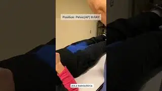 RX The Pelvic position #medicalstudent #radiology #viral #foryou #xray