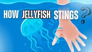 How Jellyfish Stings | Revealing the secret behind Jellyfish stings #thewwinsight