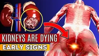Stop These 8 Worst Daily Habits That Can Quickly Destroy Your Kidneys