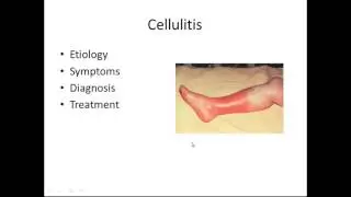 Integumentary Infective Disorders