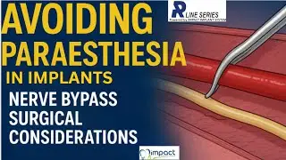 ⚠️ Don&rsquo;t Damage the Nerve! 🚫 Master Surgical Bypass in Implants