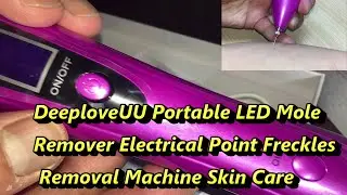 REMOVE FRECKLES AND MOLES -PORTABLE PEN #removemoles
