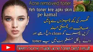 Acne removed toner )best result ✨💯 recommend one time use result like wow 🙀