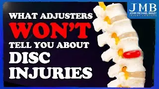 Hidden Injuries: What You Need To Know About Disc Injuries