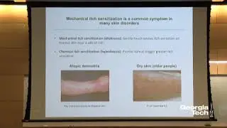 Genetic Dissection of Spinal Circuits Processing Mechanical Itch