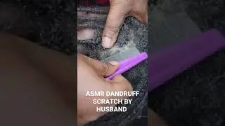 New Dandruff Scratching Video WILL put you to SLEEP