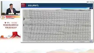 Practical Application of PFA in the Treatment of Supraventricular Tachycardia