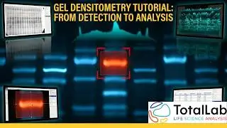 Phoretix 1D Tutorial: 1D Gel Analysis & Densitometry Software Demo