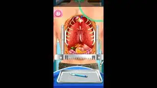Open Heart Surgery Game Offline :Doctors Games Android gameplay