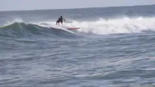 Todd Below Knee Amputee Surfer