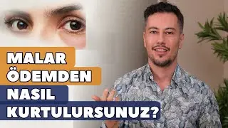 Malar Ödemden Nasıl Kurtulursunuz?