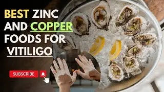 Best Zinc and Copper Foods for Vitiligo Patients
