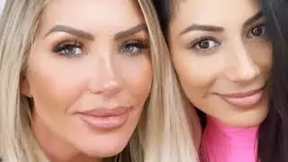 Stunning Plastic Surgery Transformations From Athletes' Wives