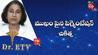 Pigmentation On The Face - Treatment | ముఖం పైన పిగ్మెంటేషన్ &ndash; చికిత్స Dr.ETV | 13th June 2022