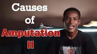 Causes of Amputation II