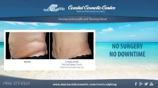 CoolSculpting Fat Removal available at Coastal Cosmetic.
