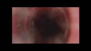 Singapore Healthy Lifestyle Campaign 2014 - Smoking (Mandarin)