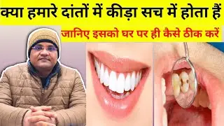  Kya hamare dato me kida sach me hota hai || Janiye esko ghar par hi kaise thik kare || 