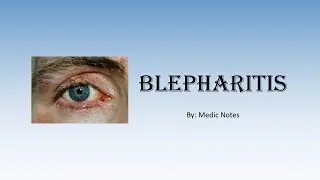 Staphylococcal and seborrhoeic blepharitis, treatment of eyelid inflammation